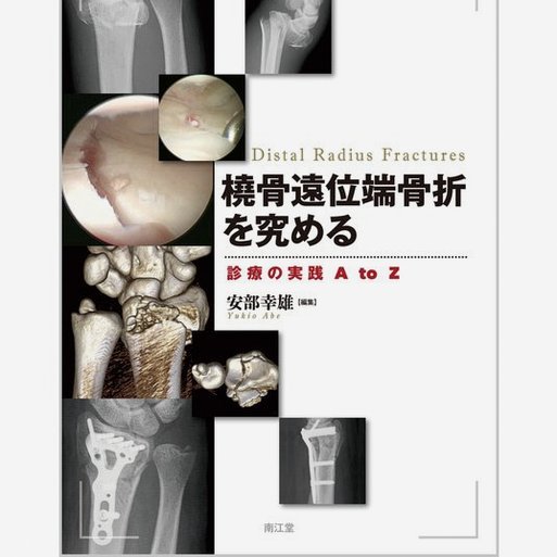 泰山外援泽卡骨折需休养6至8周